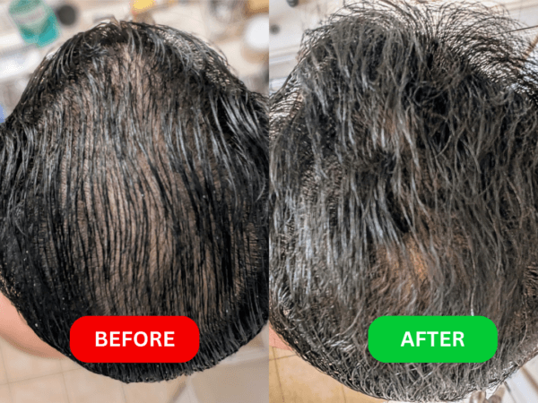 before & after