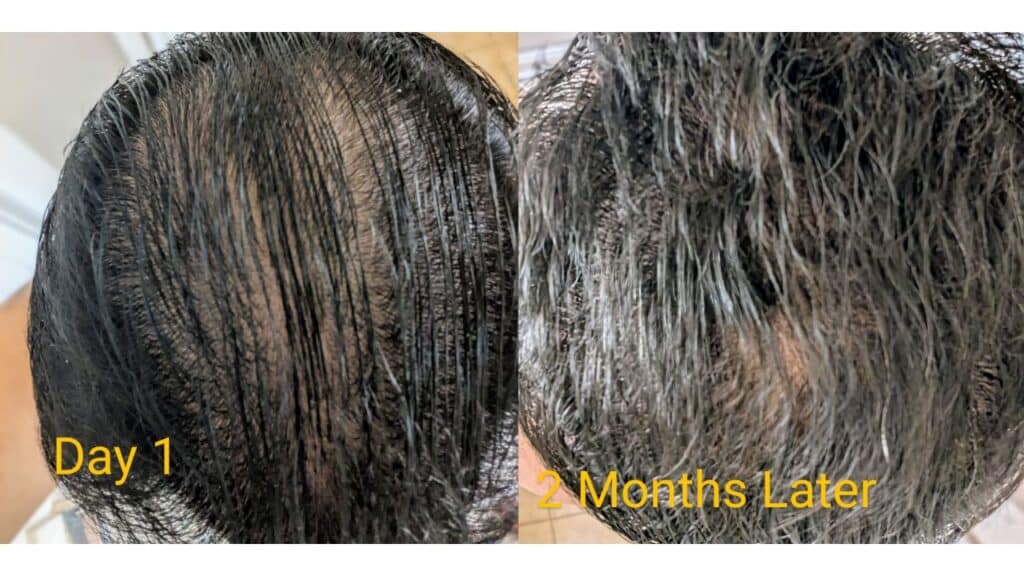 2 month results using Mane Growth Elixir