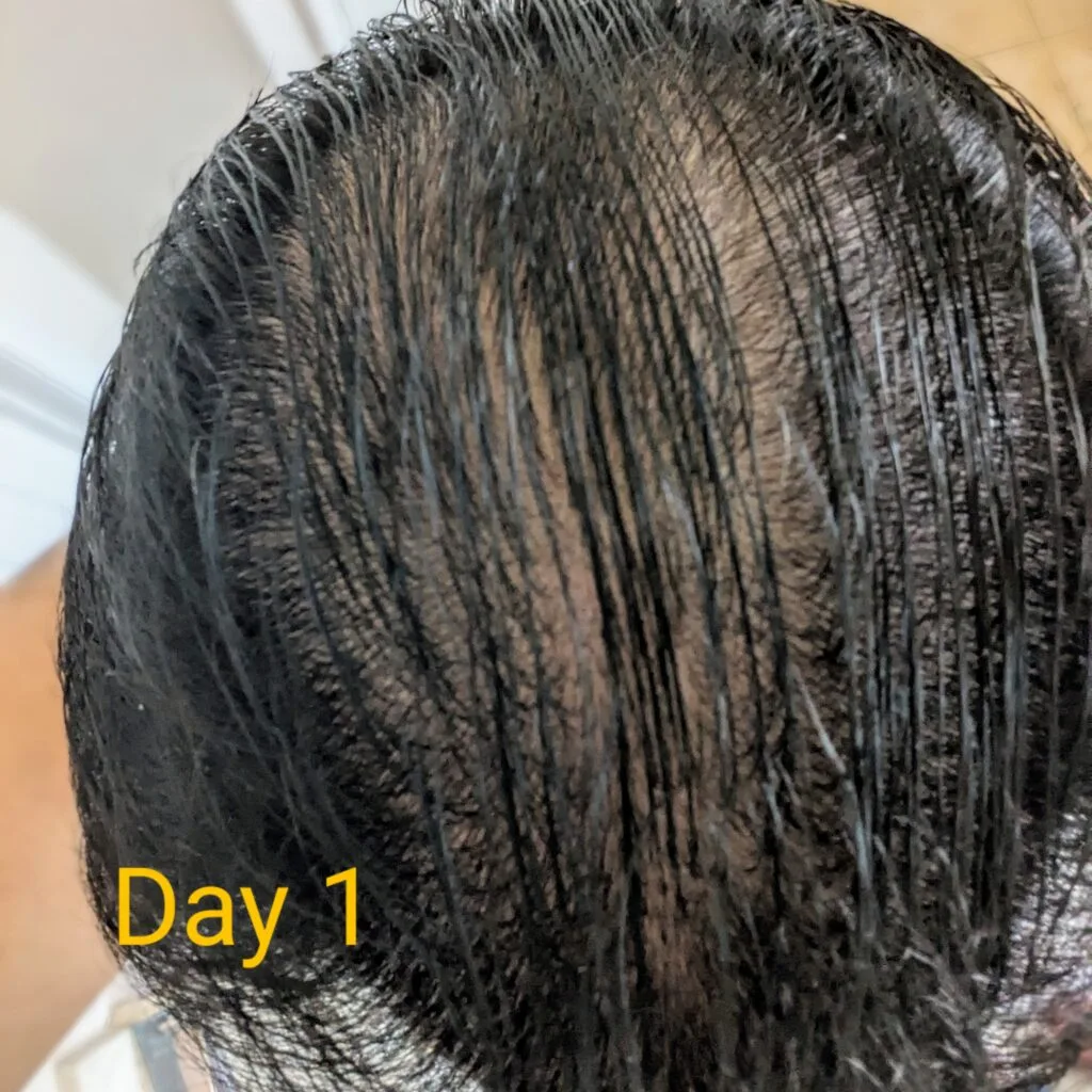 Day 1 before Mane Growth Elixir usage