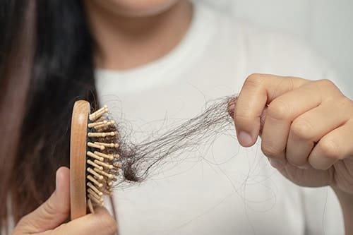 stress hair loss