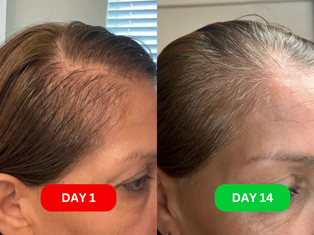 Patricia before & after 14 days