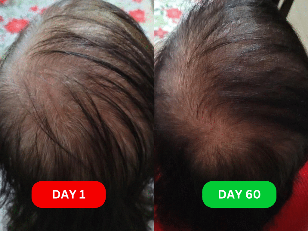 Teresa before & after 60 days